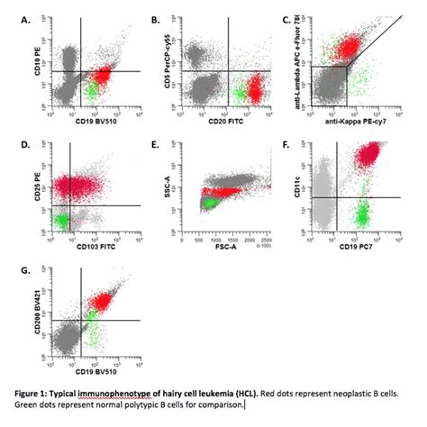 results leukemia/lymphoma panel by flow|Flow Cytometry in the Diagnosis of Leukemias .